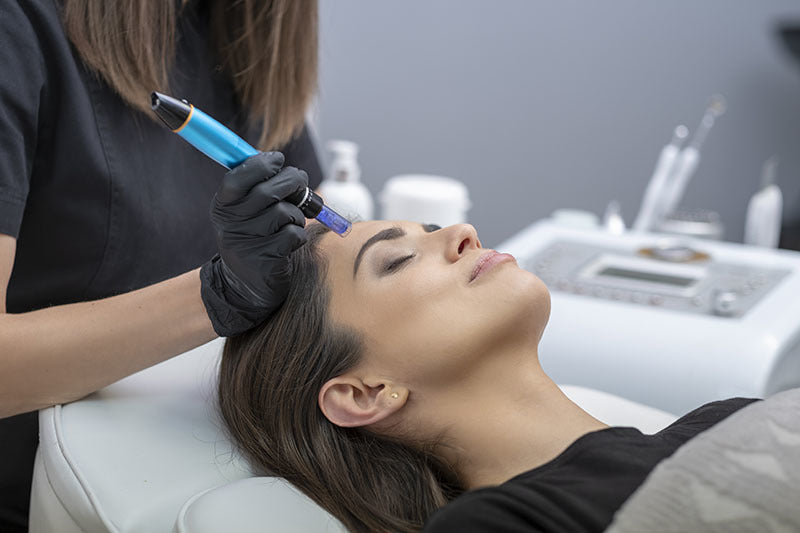 Une professionnelle en soins esthétique de la clinique Belladerma Dix30 située à Brossard, effectuant un traitement de microponcture sur une patiente 